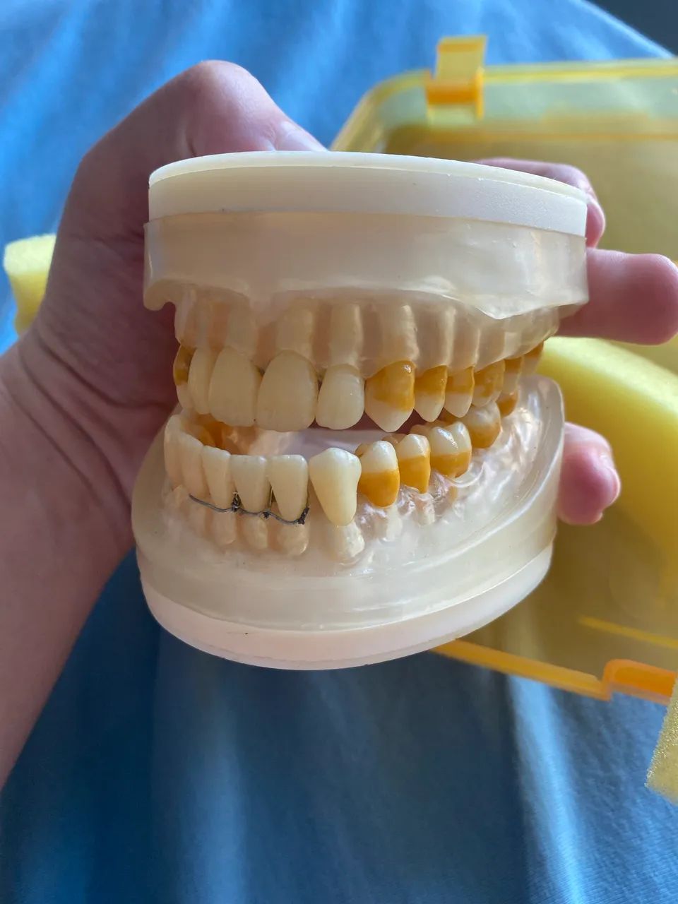 Refil Manequim De Periodontia - Foto 2