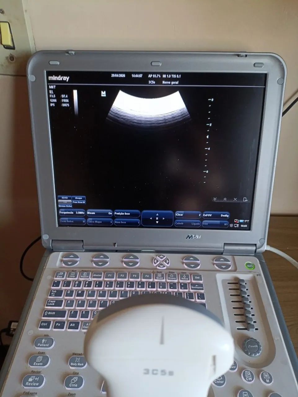 Ultrassom portátil M6 com cardio - Foto 3