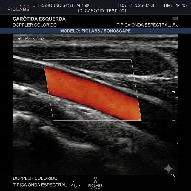 Ultrassom Portátil Doppler Colorido ano 2019 - Foto 2