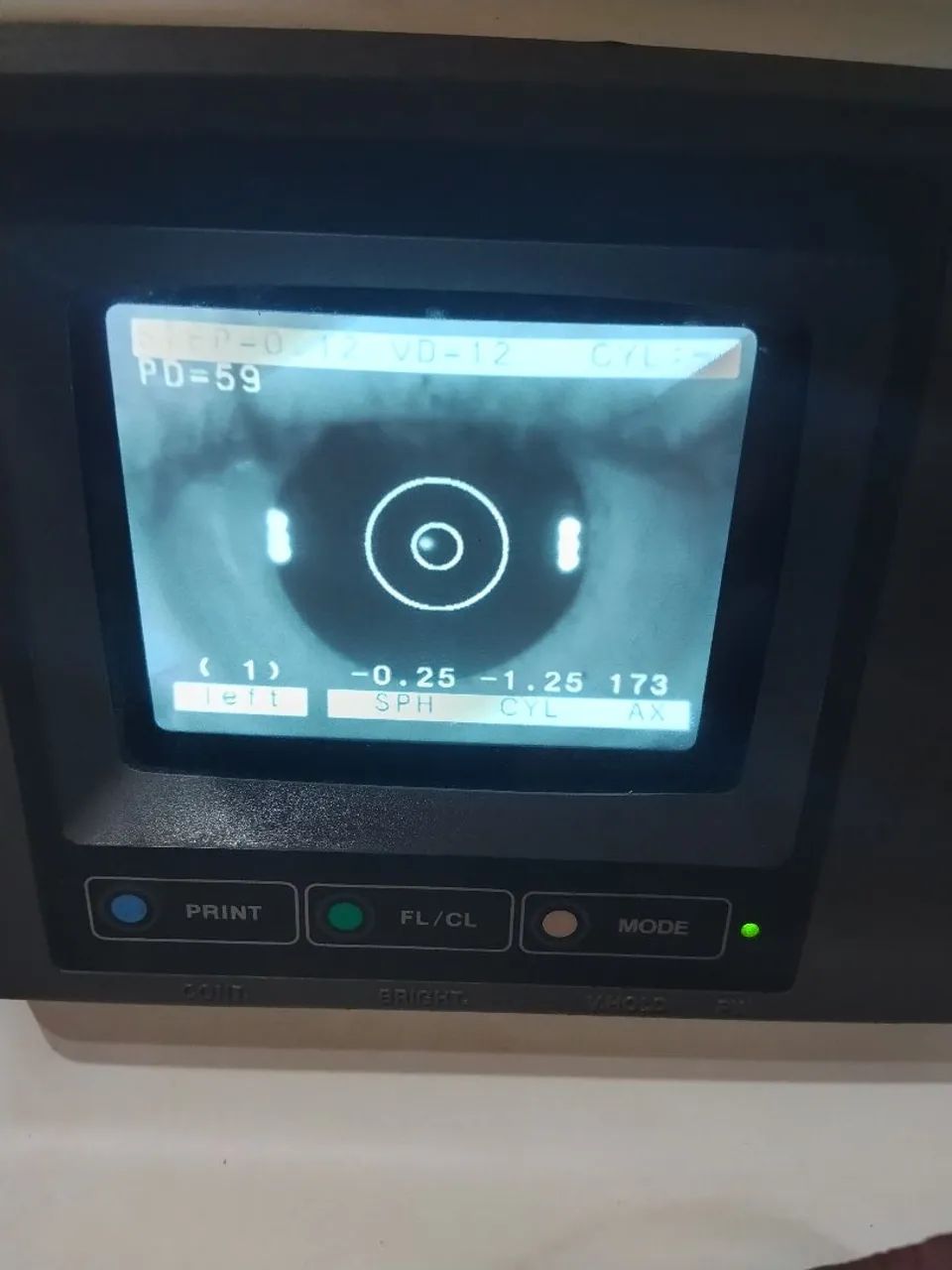 Auto refrator  - Foto 2