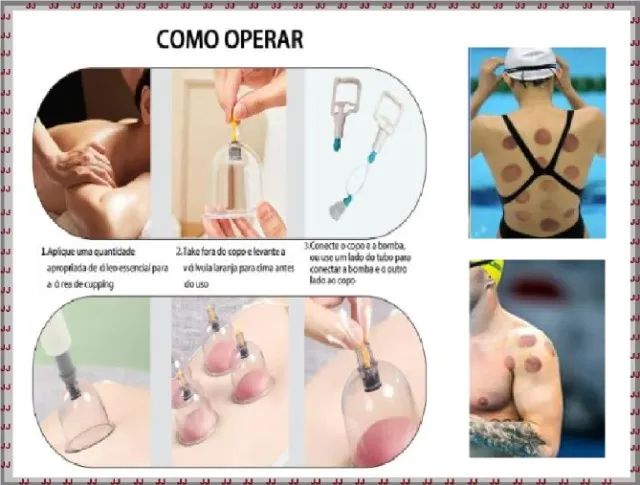 Kit de 24 copos de ventosas para ventosaterapia