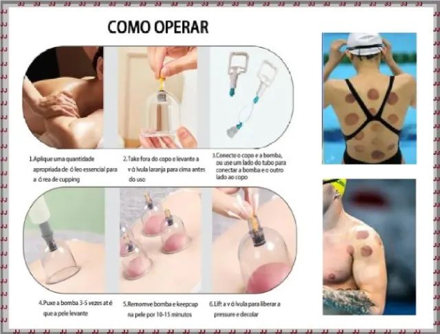 Kit de 24 copos de ventosas para ventosaterapia - Foto 4