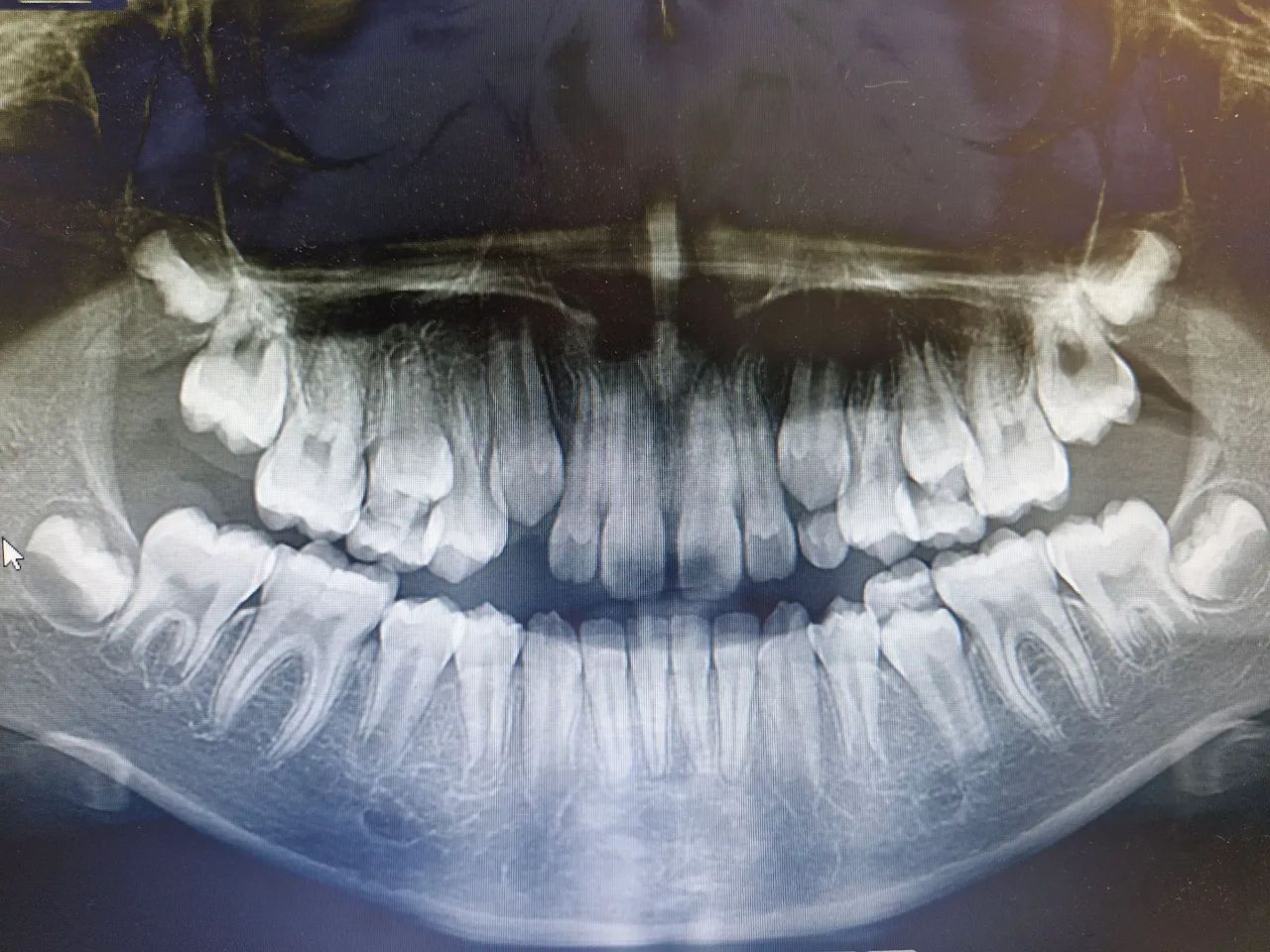 Radiografias odontológicos que cabem no seu orçamento.  - Foto 2