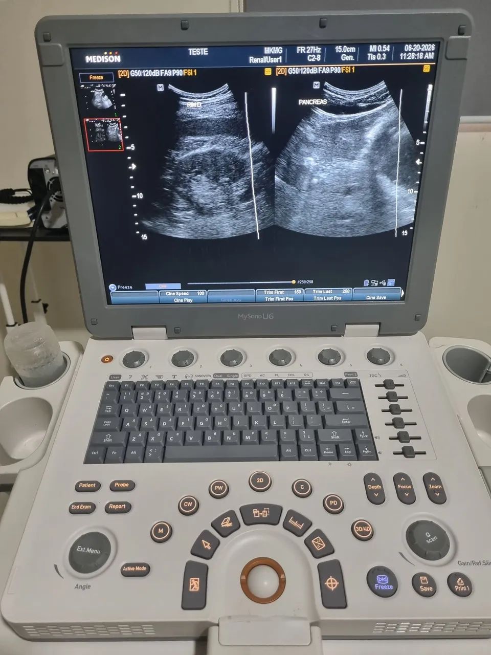 Ultrassom Sansung mysono u6 2016  - Foto 2