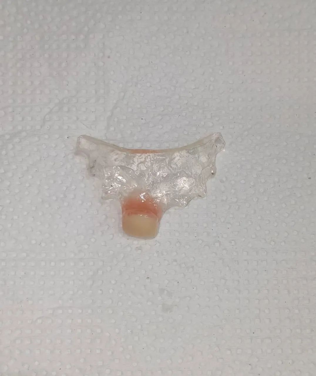 Serviços em prótese dentária (DENTADURAS) - Foto 4