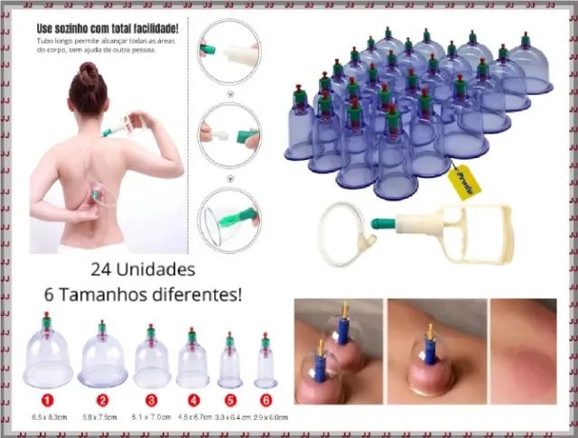Kit de 24 copos de ventosas para ventosaterapia - Foto 3