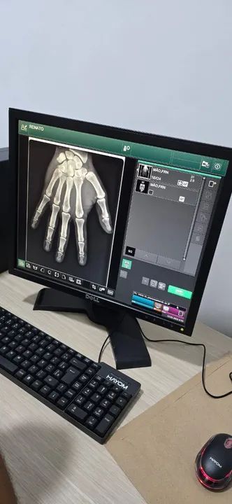  CR para raios x e mamografia  - Foto 5
