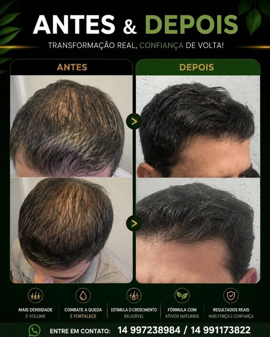 Tratamento capilar  - Foto 3
