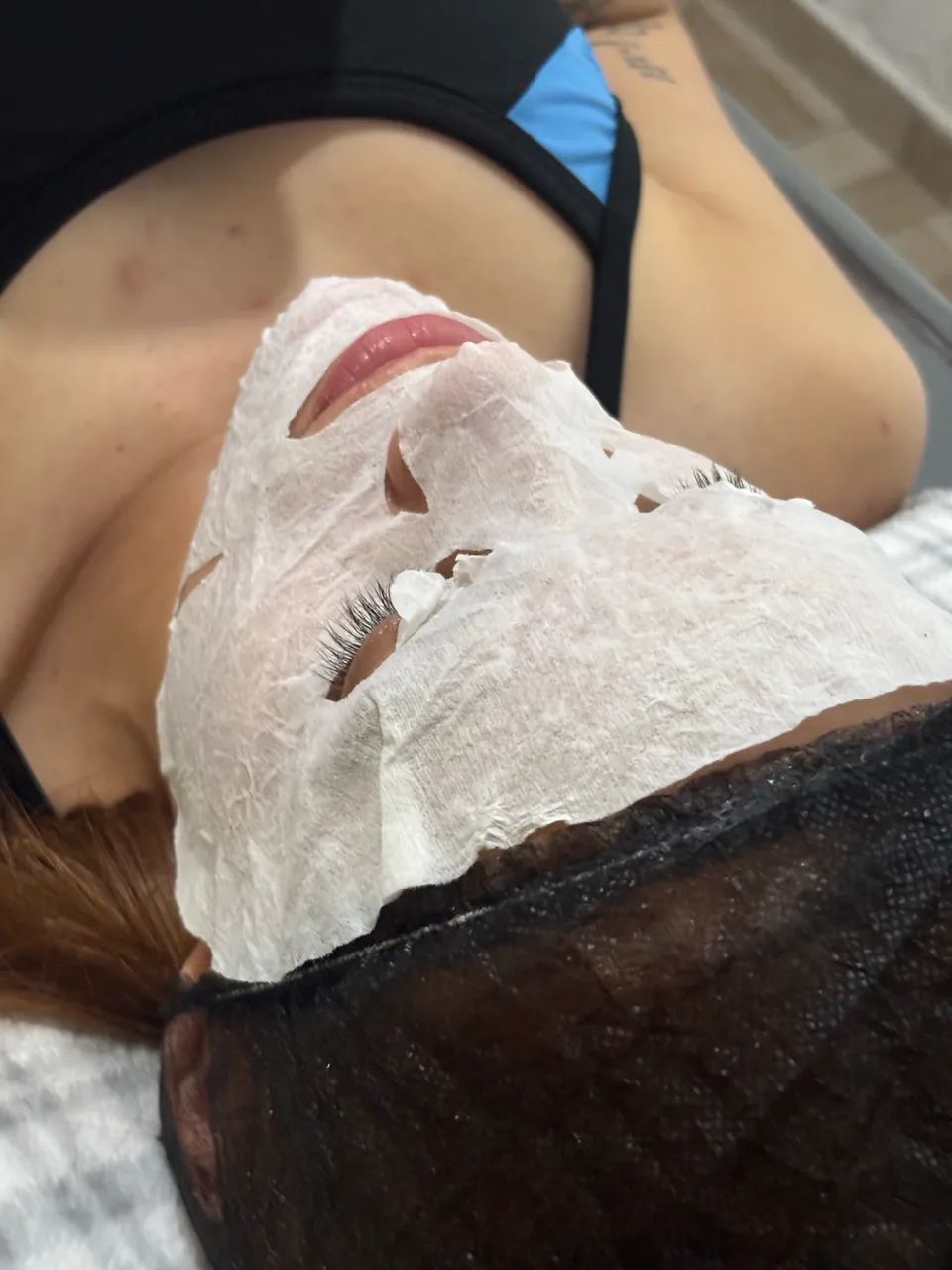 Limpeza de pele com Pelling - Foto 2