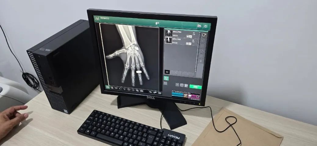  CR para raios x e mamografia  - Foto 2