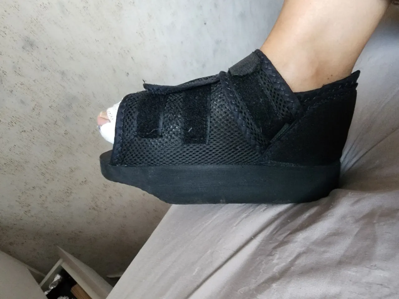 Sandália ortopédica bilateral pós cirurgia joanete 35