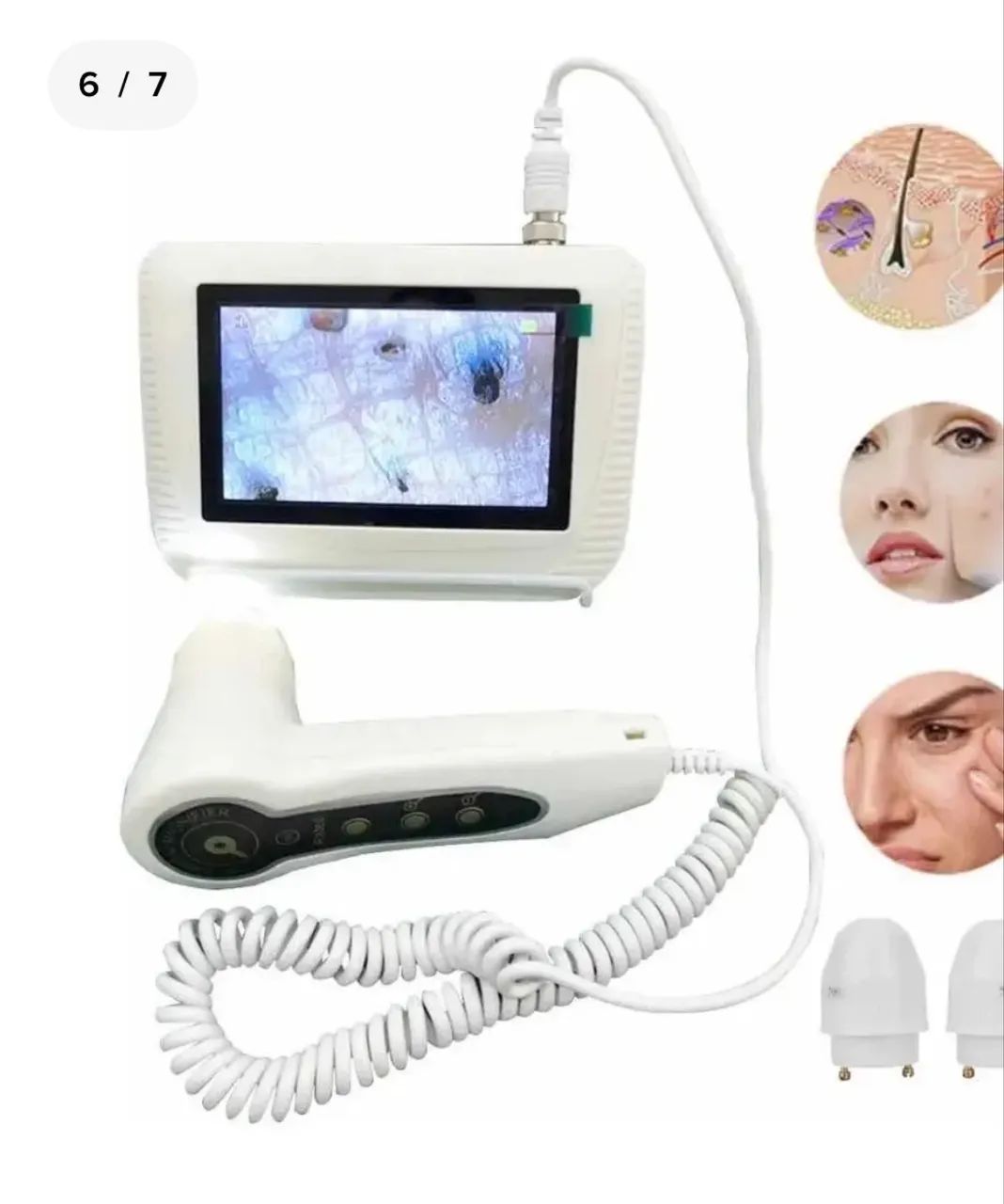 Dermatoscópio Capilar Couro Cabeludo E Análise Da Pele - Foto 2