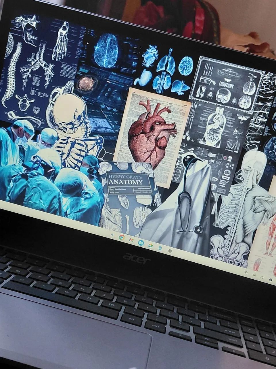 Notebook acer  - Foto 3