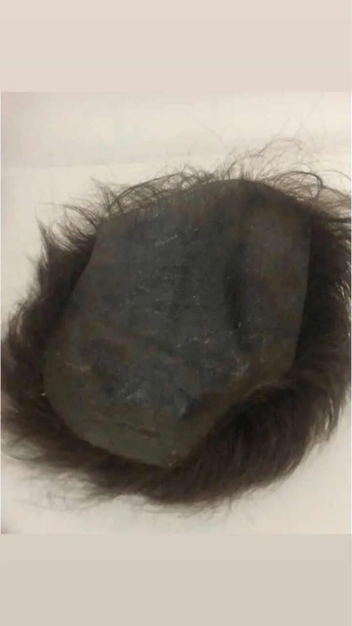 Prótese Capilar masculino ( Cabelo Humano )