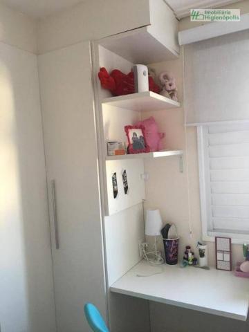 Apartamento com 3 dormitórios à venda, 60 m² por r$ 330.000 - parque bandeirante - santo a - Foto 7