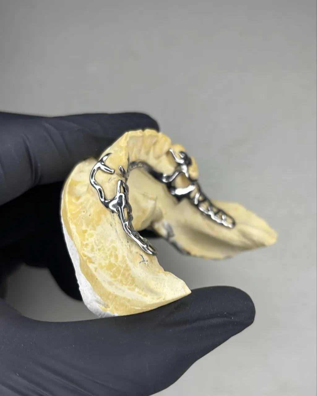 Laboratório de Prótese Dentária - Qualidade, Agilidade e Ótimo Preço! - Foto 5