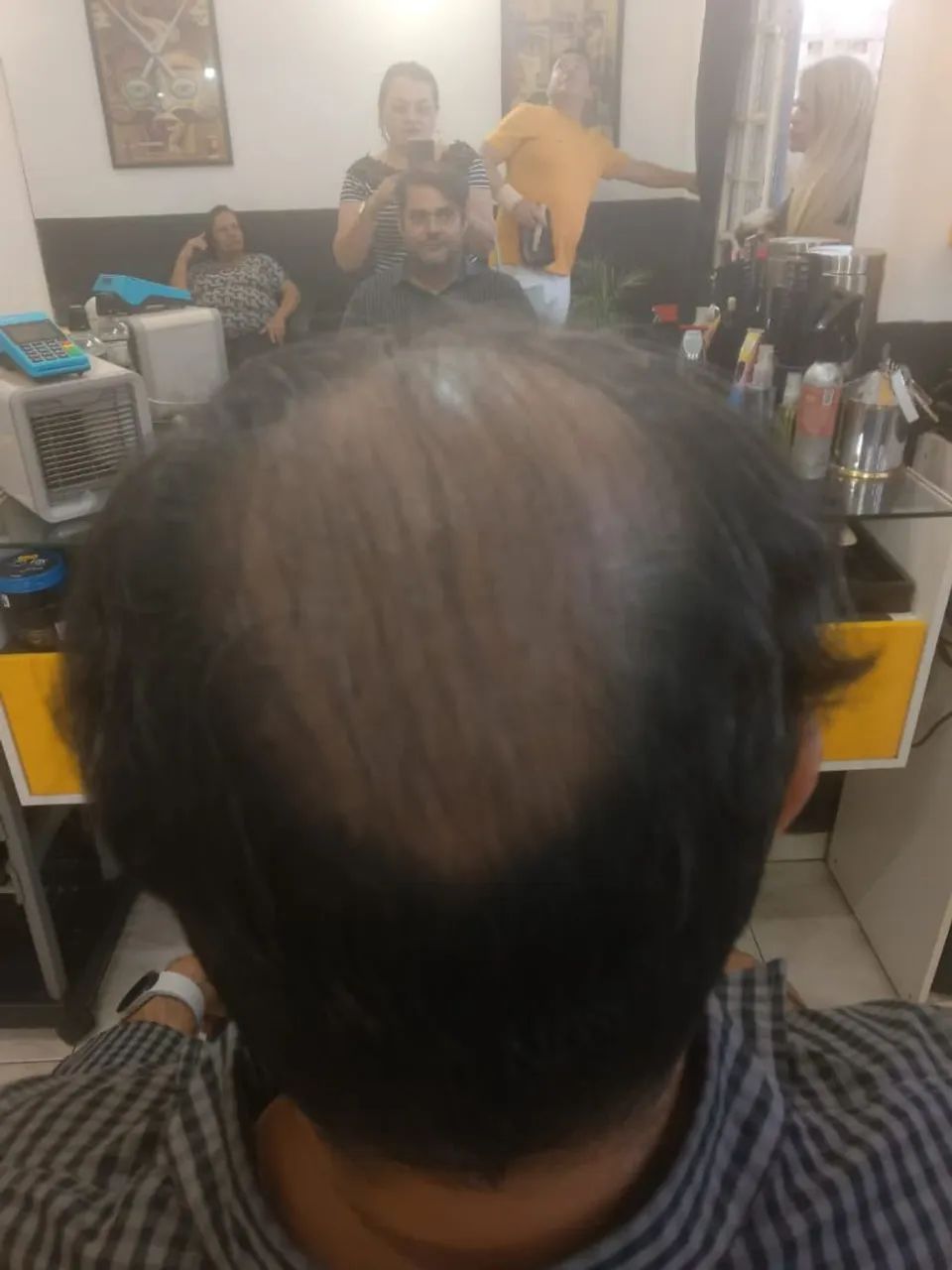 Cabelos humanos prótese capilar  - Foto 4