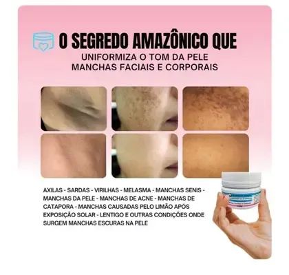 Clareador de mancha de pele ( PAGUE SÓ NA ENTREGA ) - Foto 3