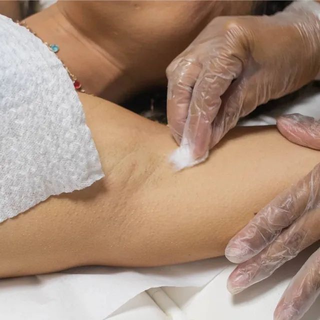 Depilação Cera Quente - Foto 4