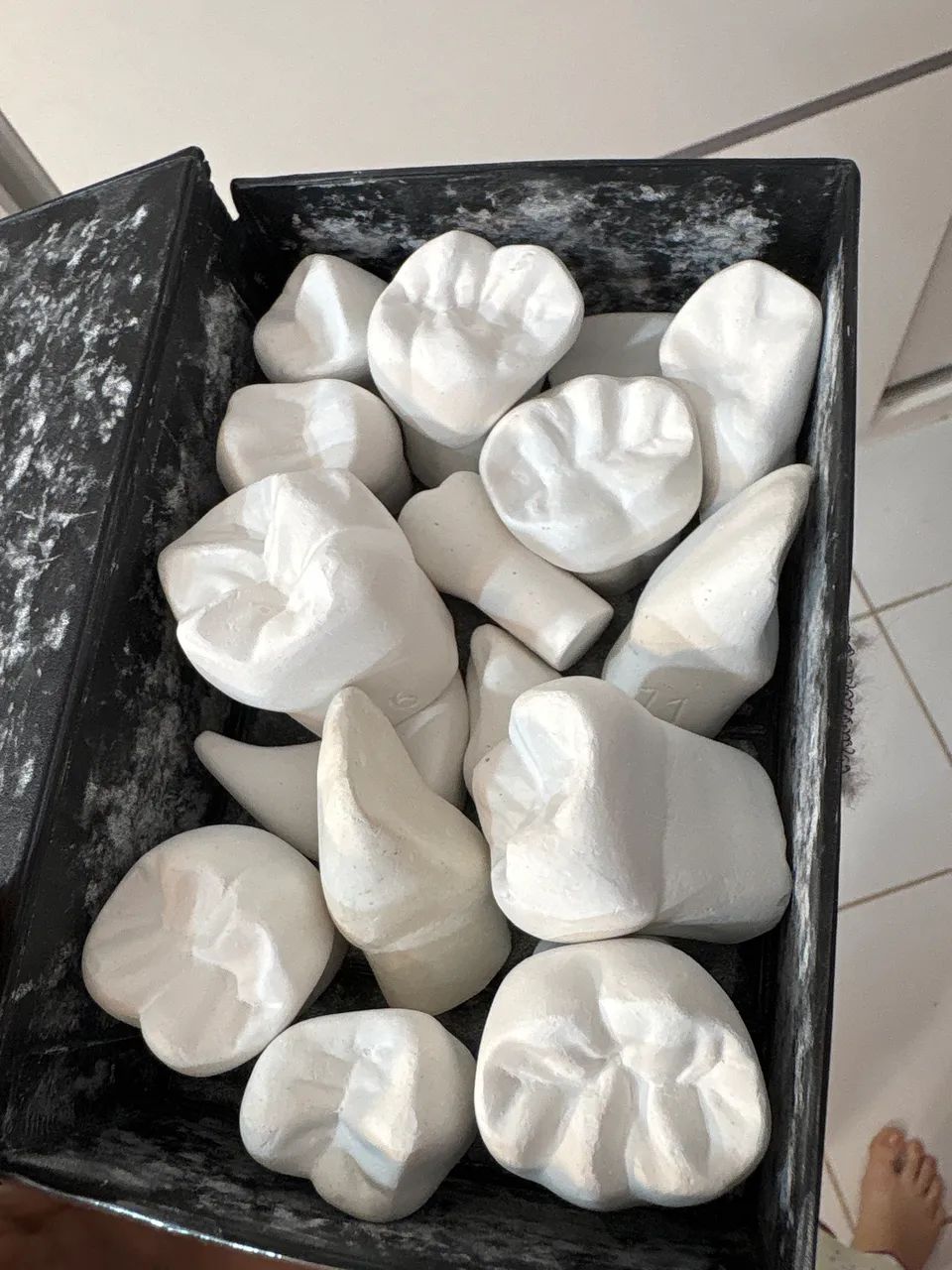 Macro modelo de dente  - Foto 2