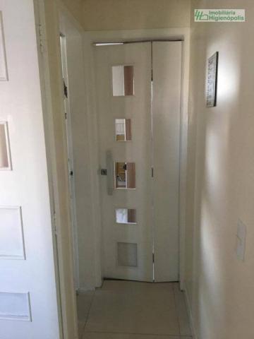 Apartamento com 3 dormitórios à venda, 60 m² por r$ 330.000 - parque bandeirante - santo a - Foto 11