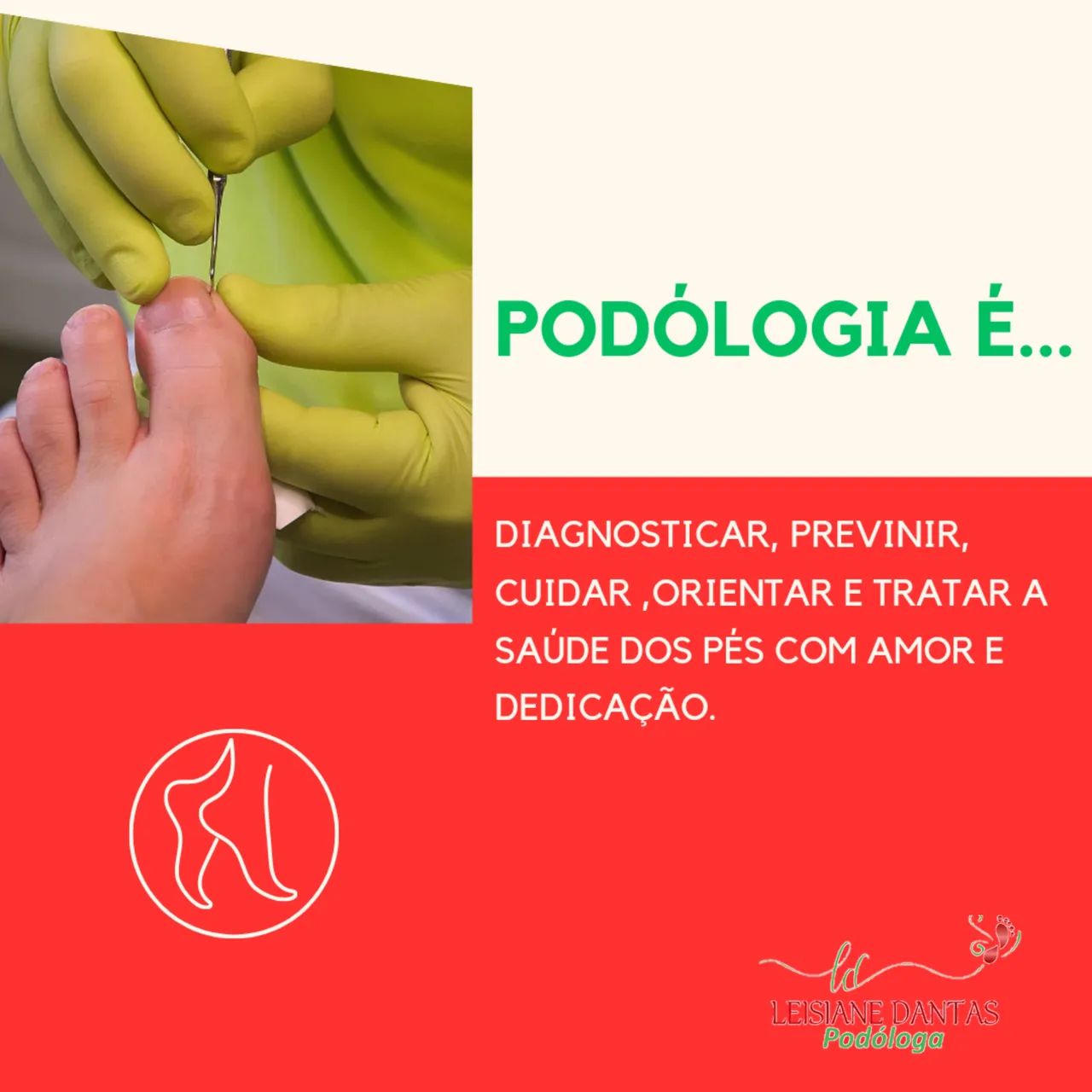 Unha Encravada? Livre-se do problema com Podóloga! - Foto 4