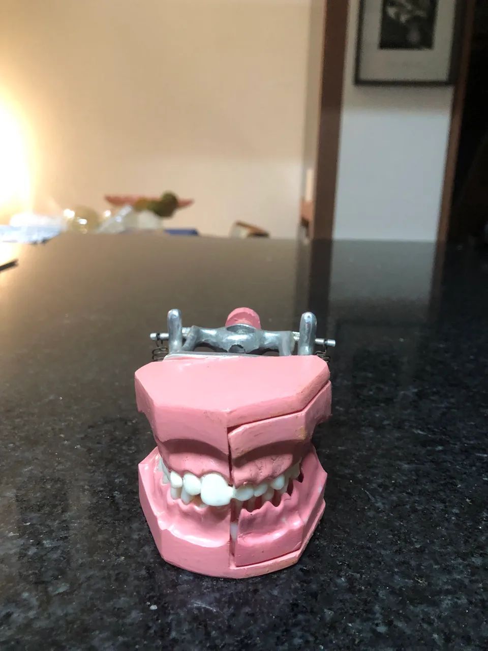 Marco modelo de dentição infantil mista  - Foto 2