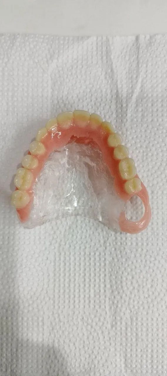 Serviços em prótese dentária (DENTADURAS) - Foto 5