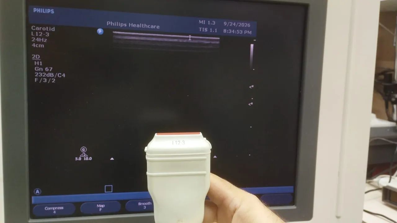 ULTRASSOM ( SONDAS PHILIPS ) - Foto 3