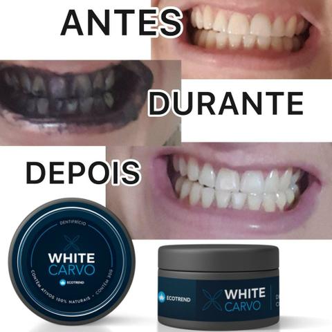 White carvo clareador dental - Foto 2