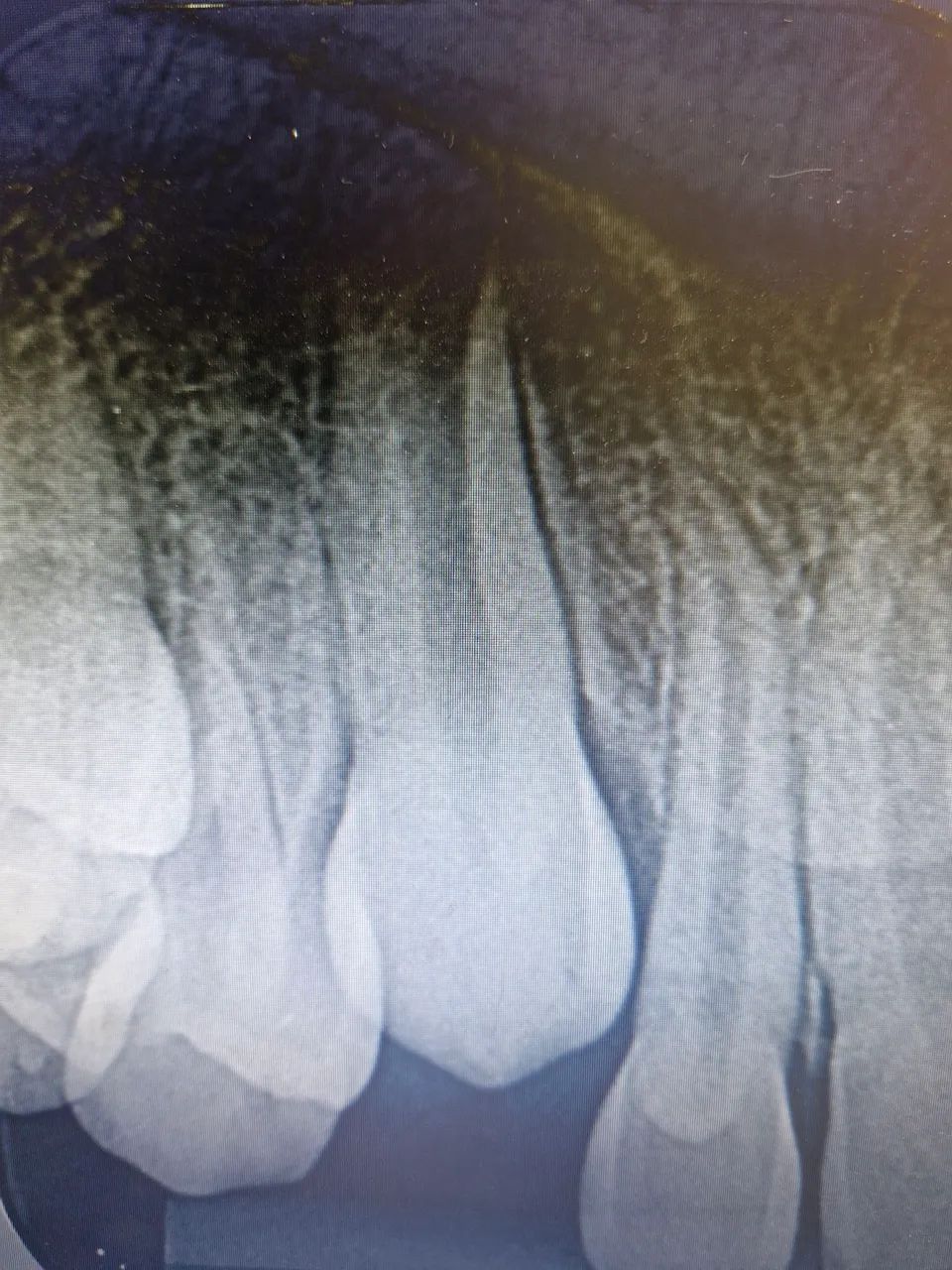 Radiografias odontológicos que cabem no seu orçamento.  - Foto 3