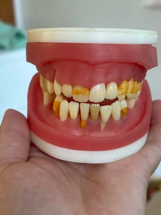 Refil de periodontia - Foto 2