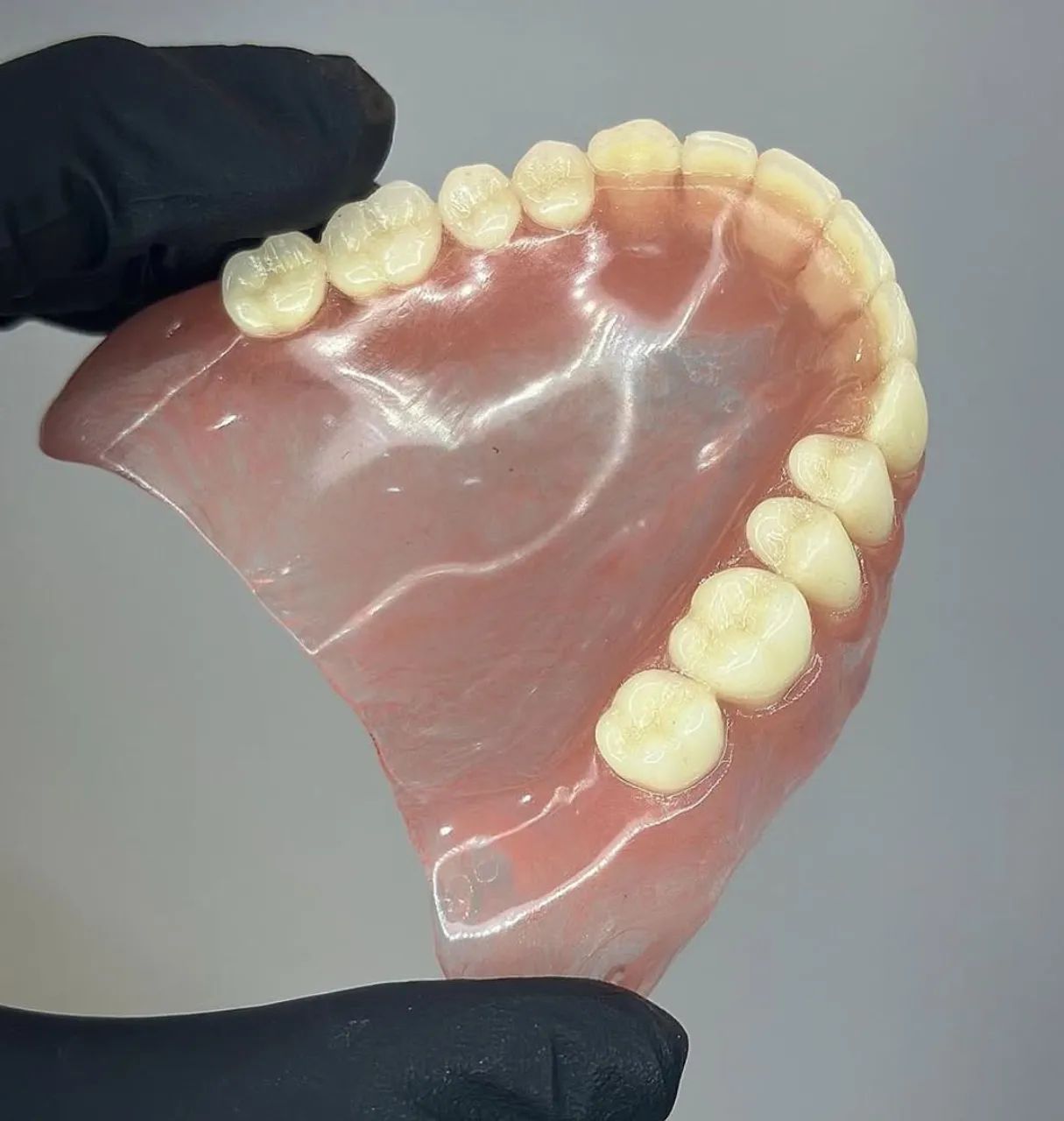 Prótese dentária  - Foto 2