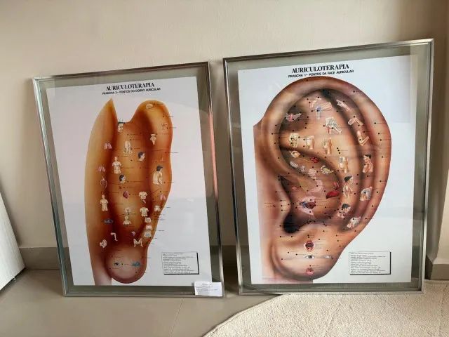 Quadro de Pontos para Auriculoterapia