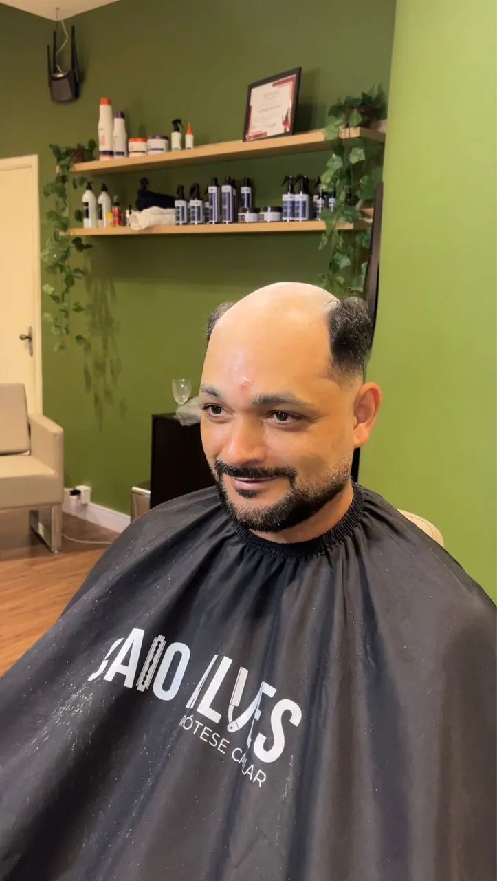 MODELO PARA PRÓTESE CAPILAR