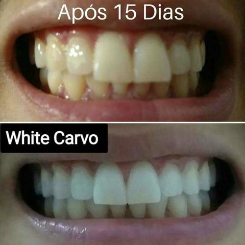 White carvo clareador dental - Foto 3