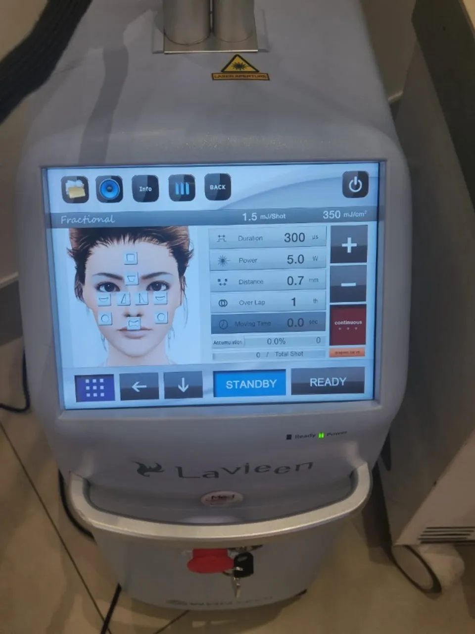 Lavieen Laser 2023  - Foto 3