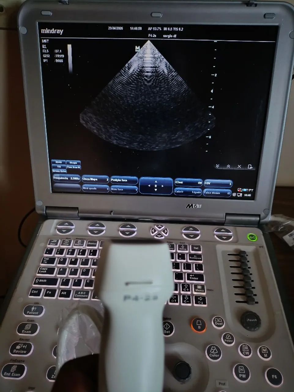 Ultrassom portátil M6 com cardio - Foto 4