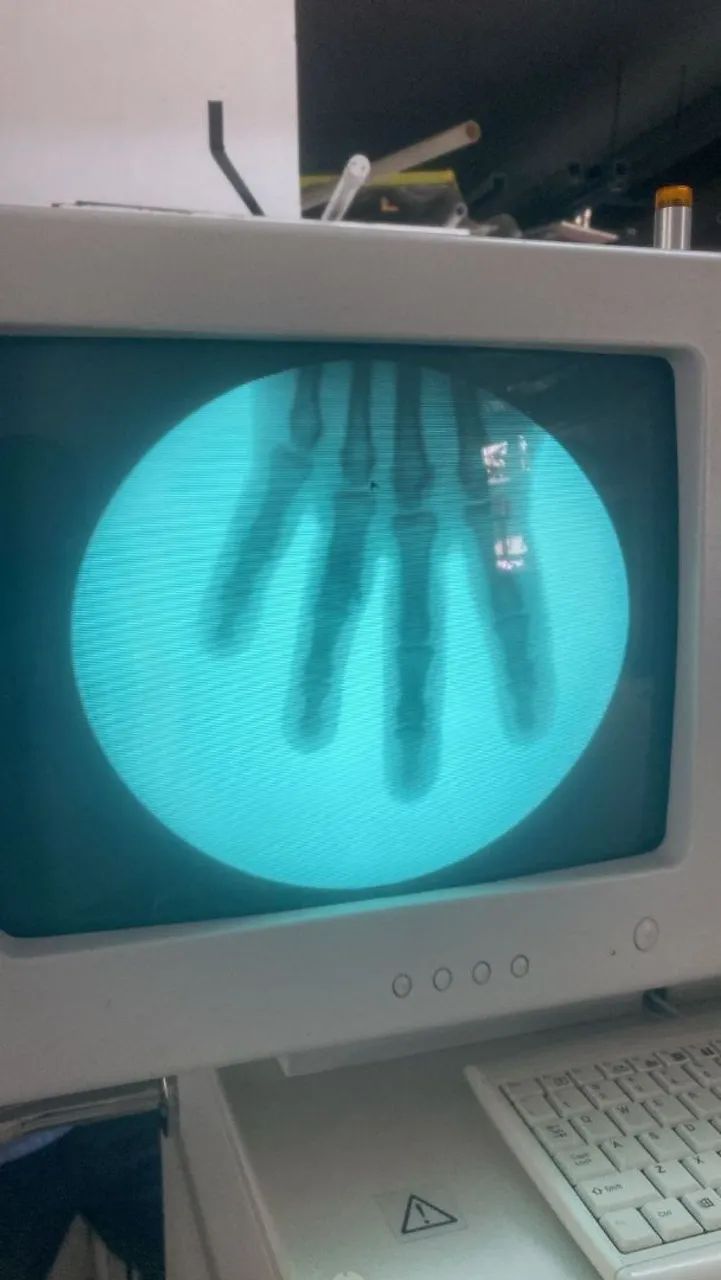 Arco cirurgico g.e 7500