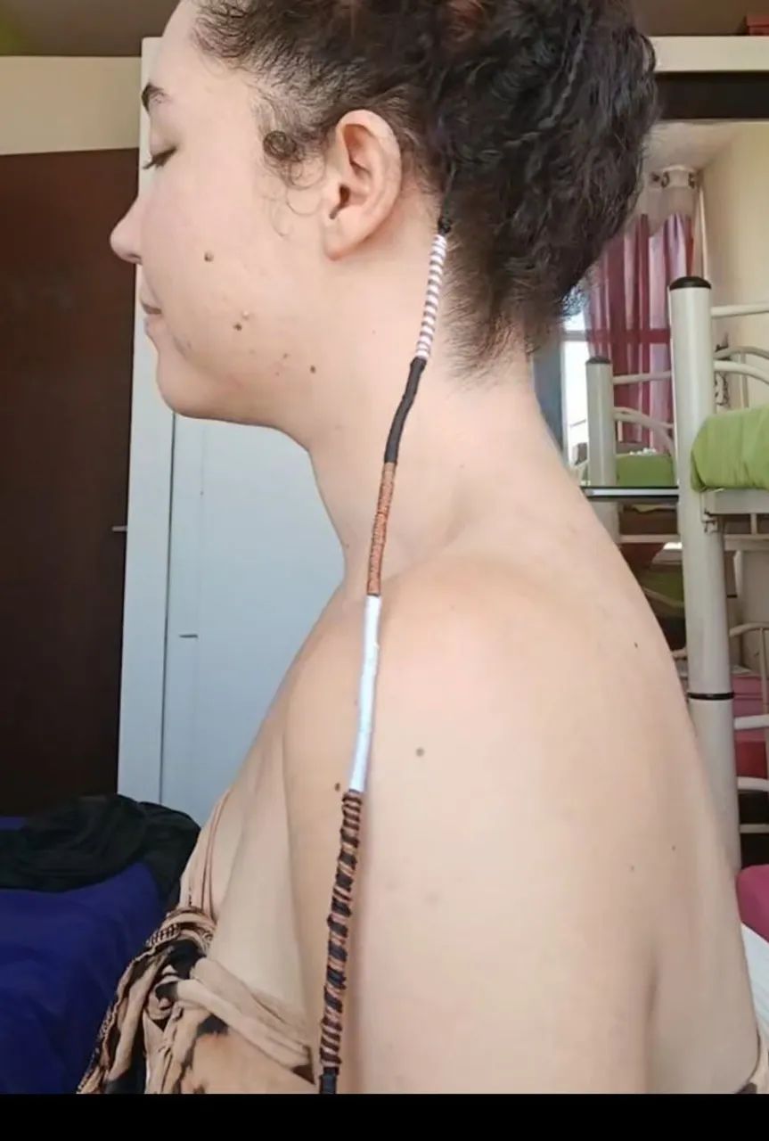 Terere removível  - Foto 2