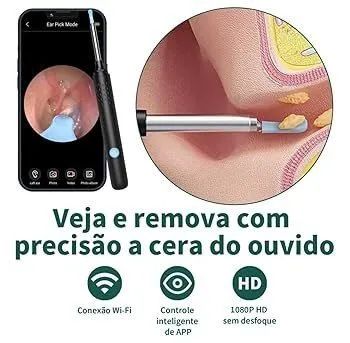 Limpeza de ouvido com câmera 