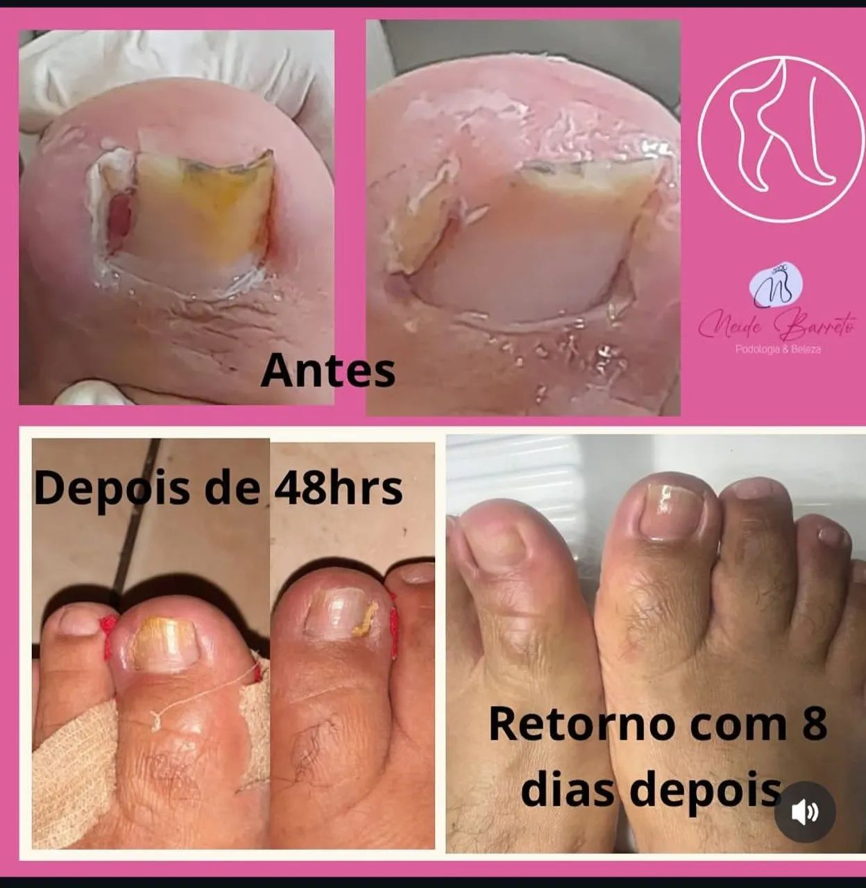 Podologia e beleza Neide Barreto  - Foto 3