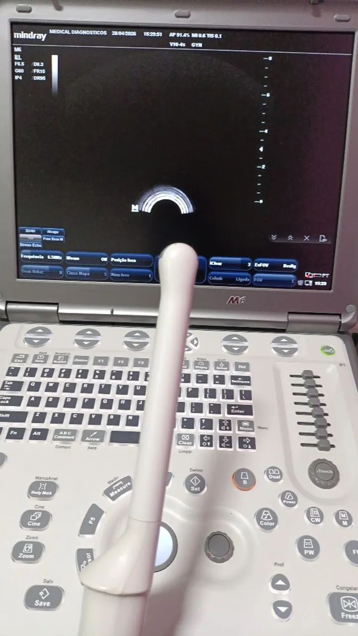 Ultrassom portátil M6 com cardio - Foto 5