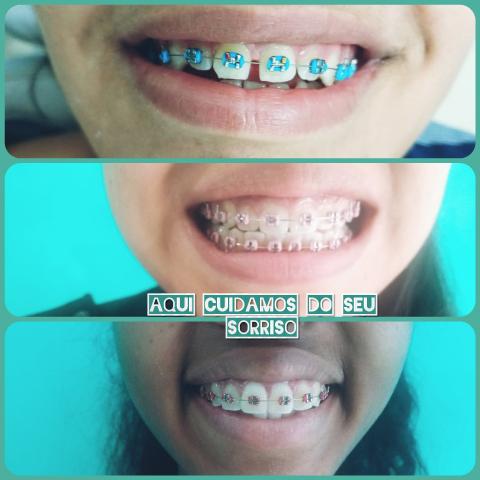 Dentista da Cidade de Deus. - Foto 5