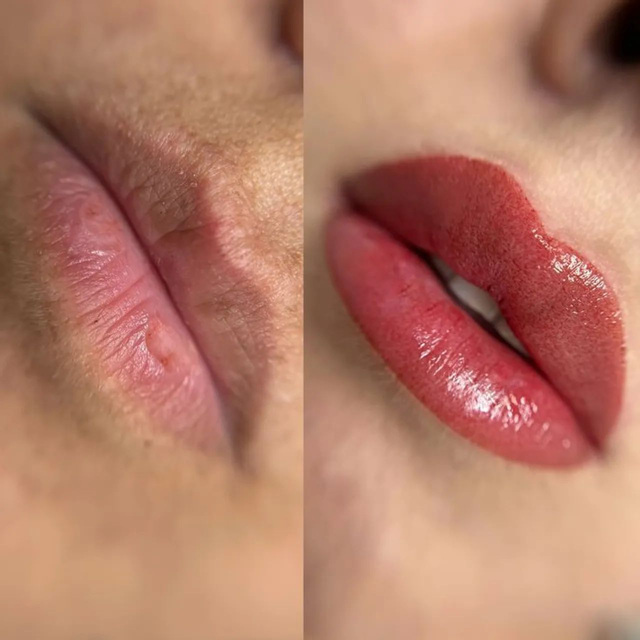 Micro labial pague só o material  - Foto 3