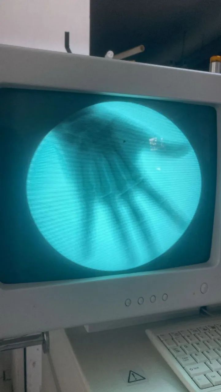 Arco cirurgico g.e 7500 - Foto 2