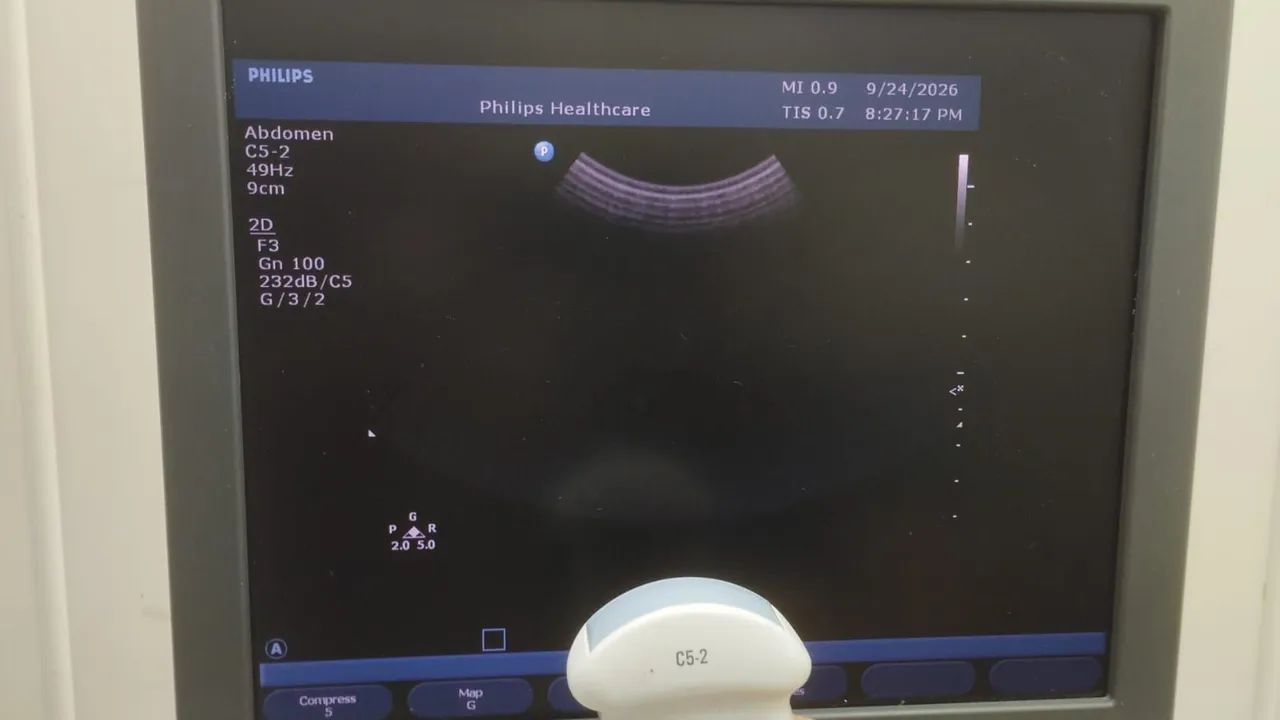 ULTRASSOM ( SONDAS PHILIPS ) - Foto 5