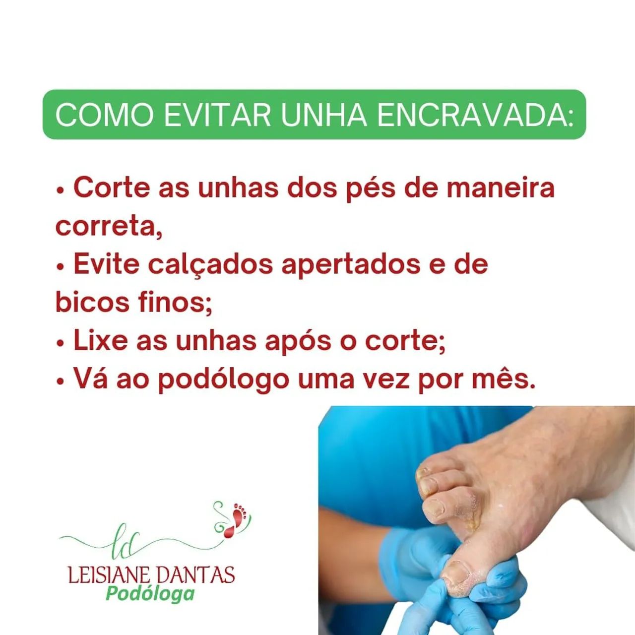 Aparelho Ortodôntico para Unhas - Novo - Foto 4