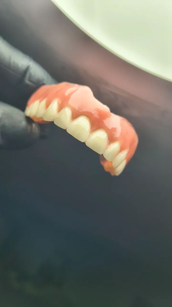 Prótese dentária  - Foto 3