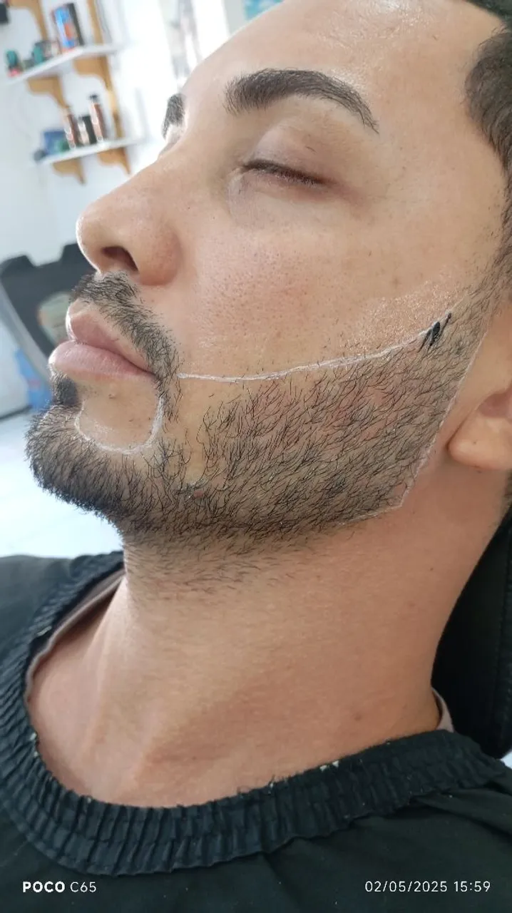 Micropigmentação de barba